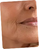 Anti Aging