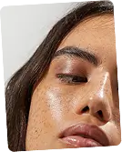 Pigmentation