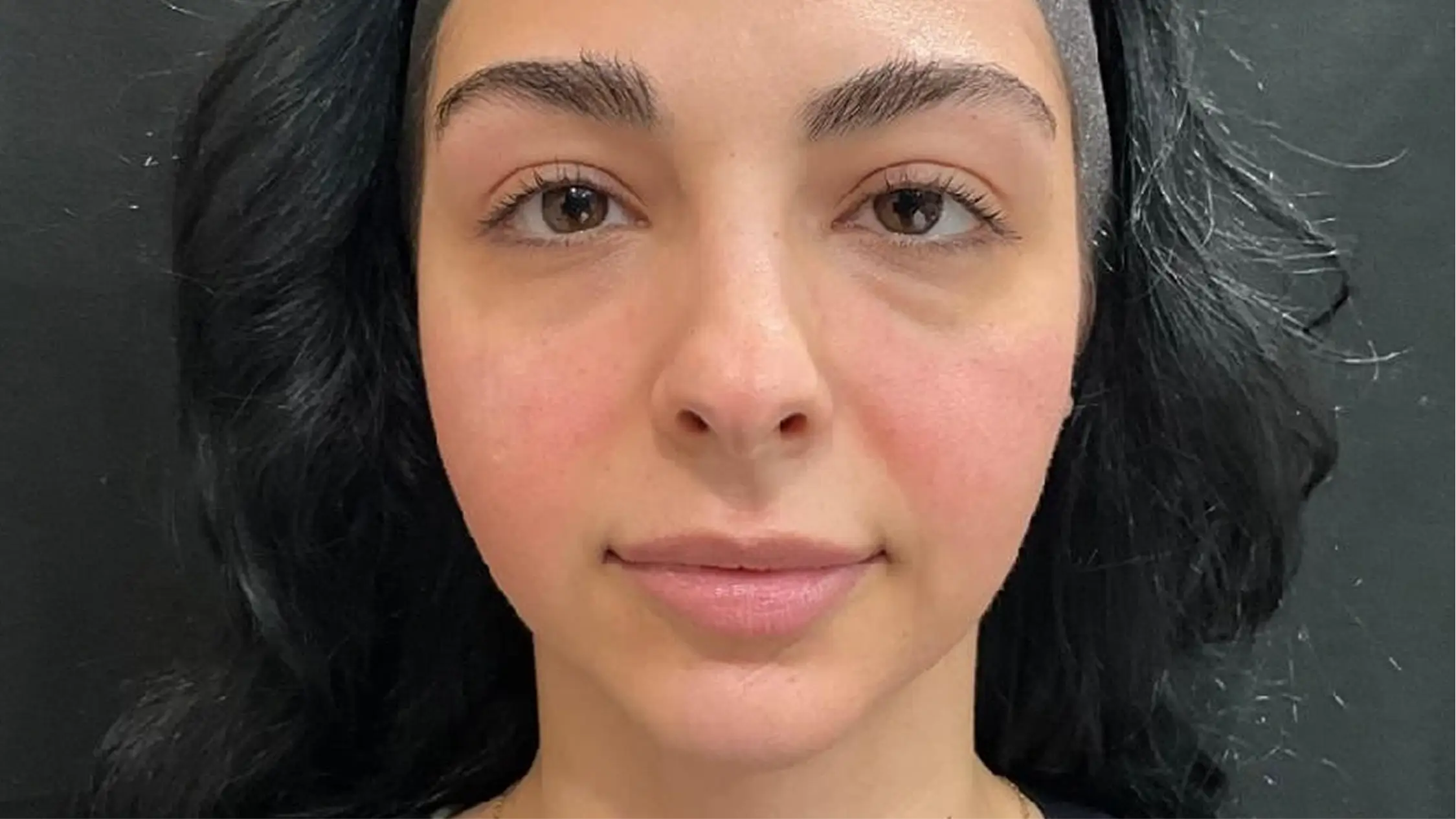 Best Skin Clinic in Bangalore