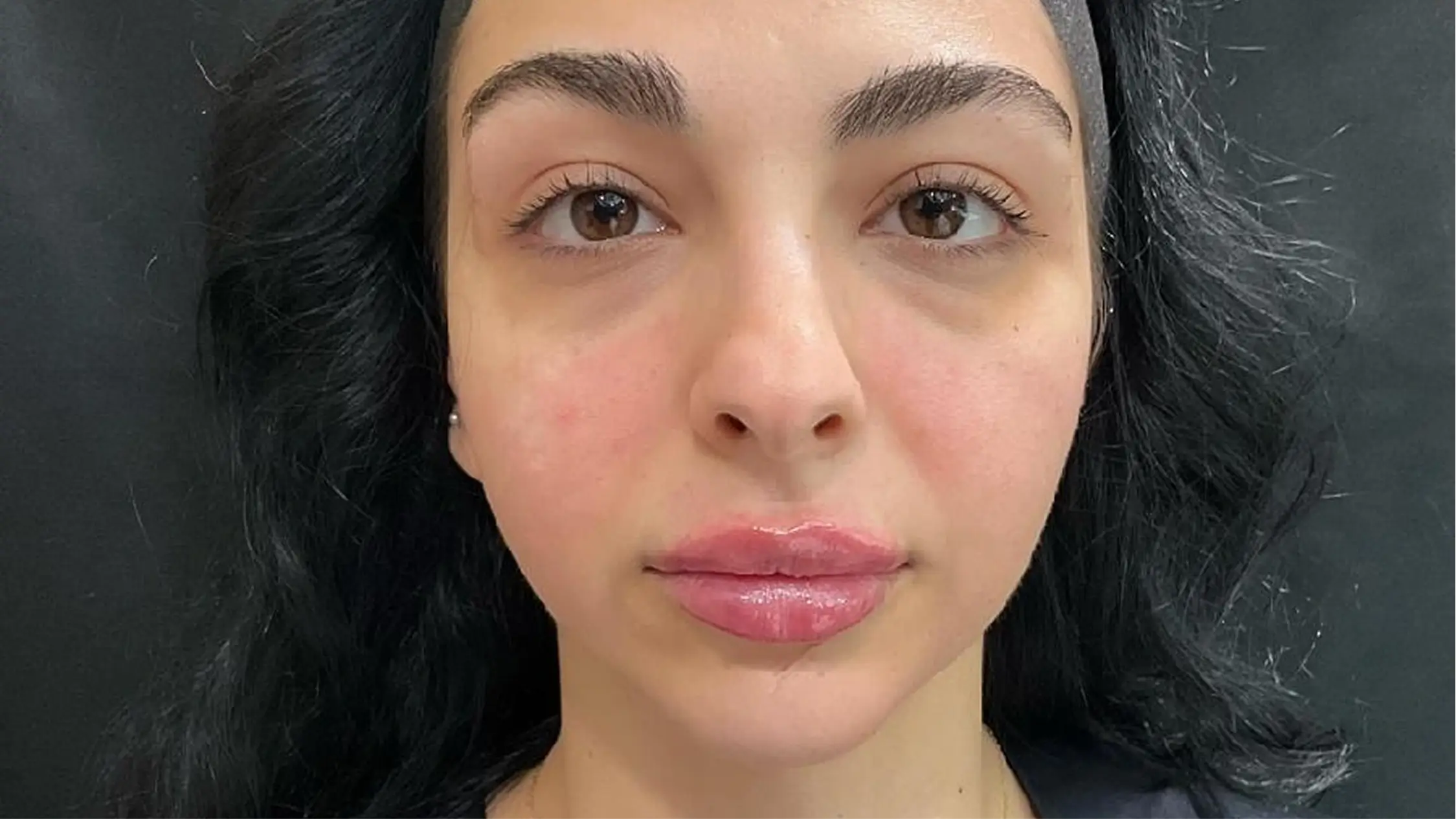 Best Skin Clinic in Bangalore